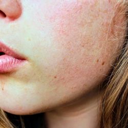 lip balms guaranteed hydration 2025